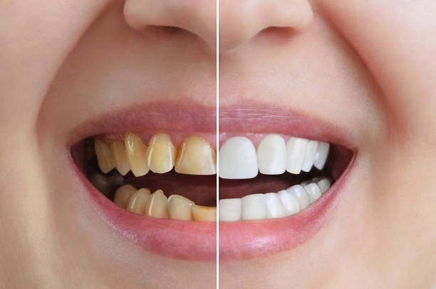 Cosmetic Dentistry & Smile Design